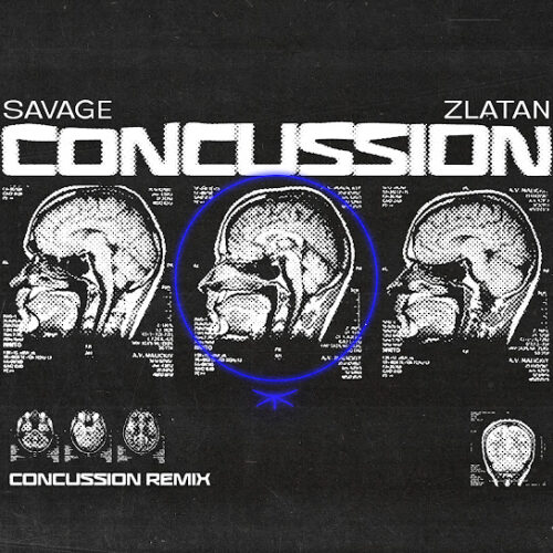 Savage - Concussion (Remix) (feat. ZLATAN)